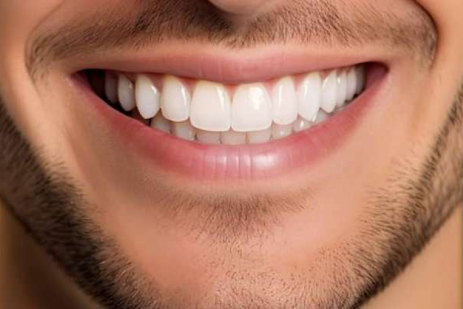 Teeth Whitening